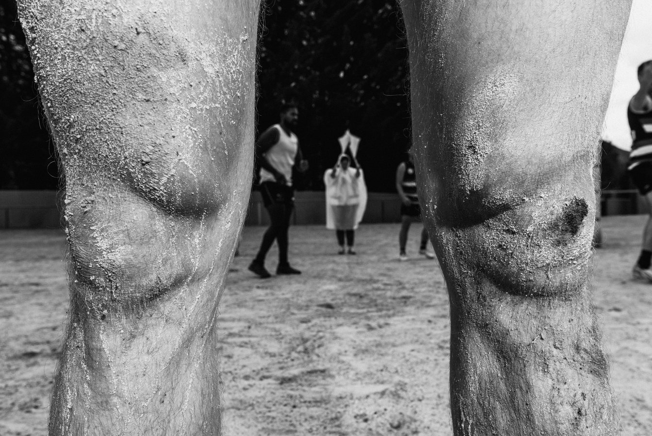 The Unconformity Cup. A black and white photo of two dirty and bloody knees. Credit Jesse Hunniford.